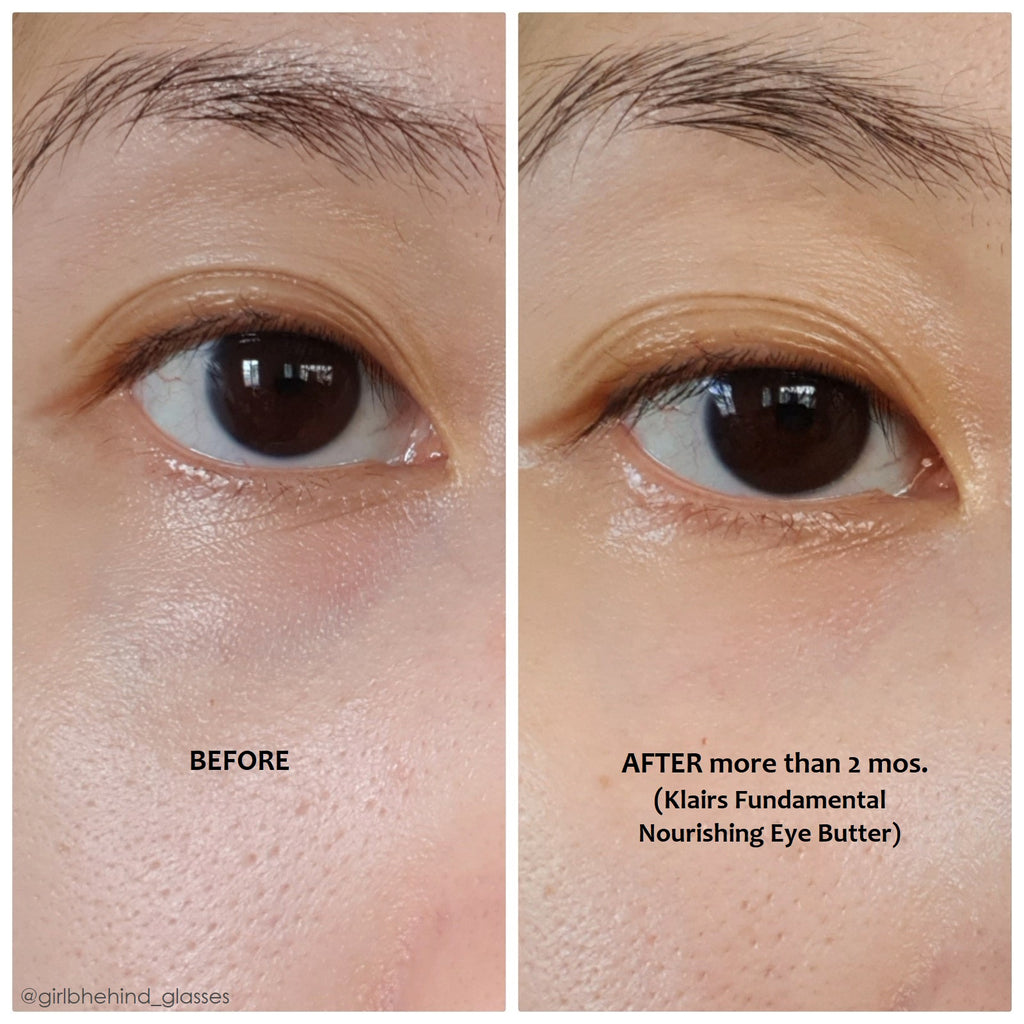 Dear Klairs Fundamental Nourishing Eye Butter 20g - Crema Contorno de Ojos con Péptidos